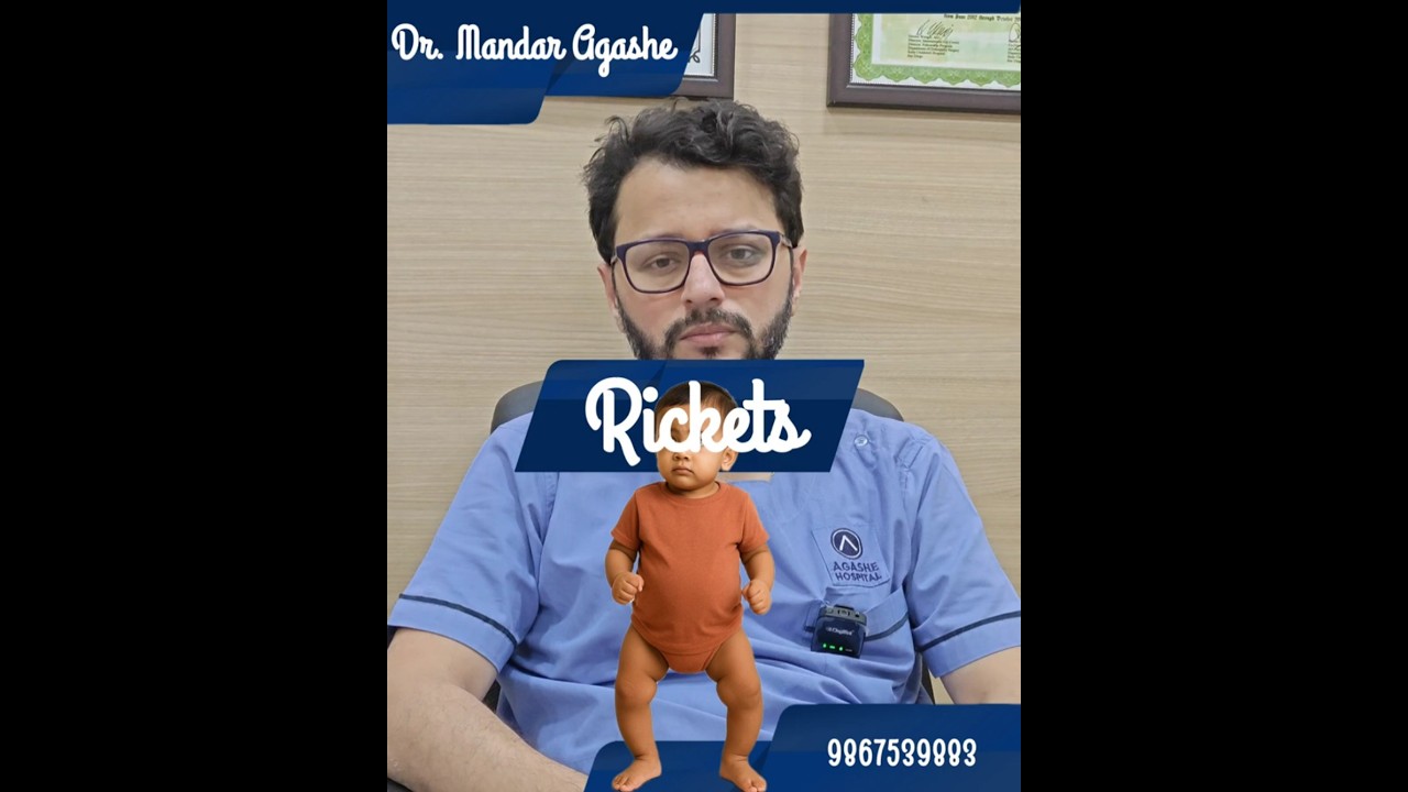 What is Rickets | Dr. Mandar Agashe