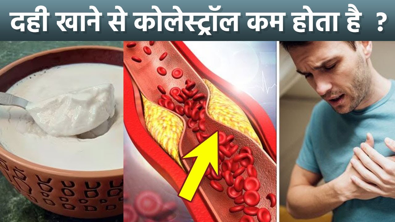 दही खाने से कोलेस्ट्रॉल कम होता है क्या | Dahi Khane Se Cholesterol Kam Hota Hai Kya | Boldsky
