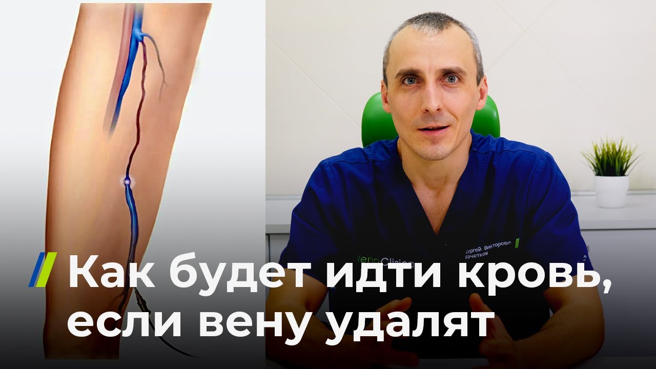 Как будет идти кровь, если вену удалят