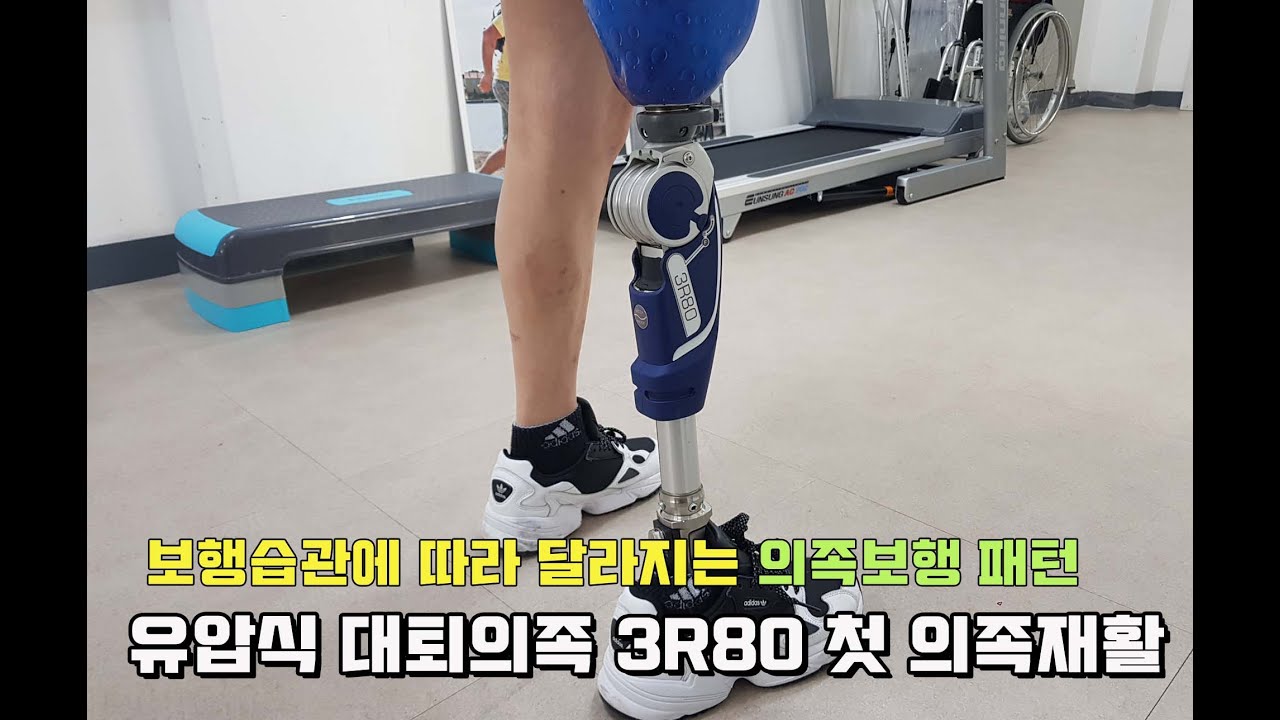 대퇴의족 오토복 3R80 첫 의족재활 : 착용자 습관에 따라 의족보행 패턴도 제각각