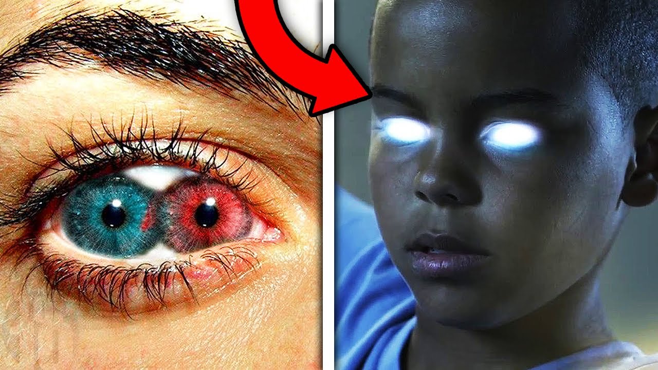 People Who Gained Real Superpowers After An Accident