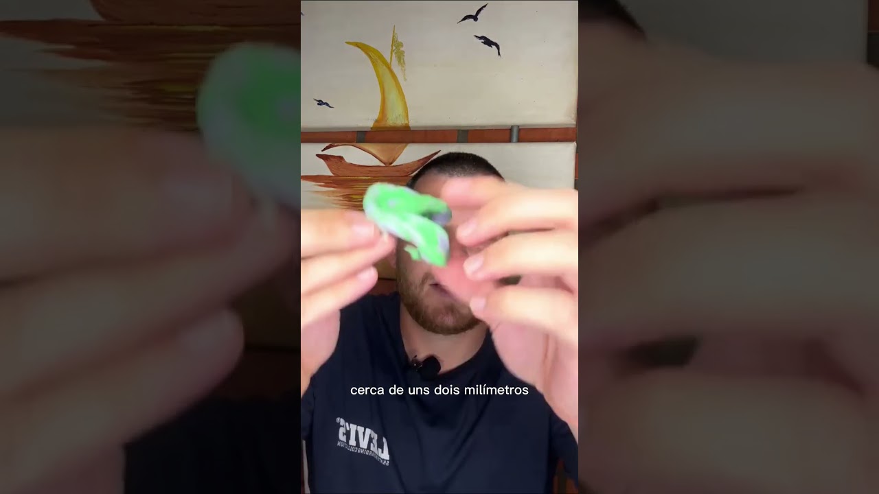 Encaixotamento do molde funcional da pr&oacute;tese total - Magno Sanches