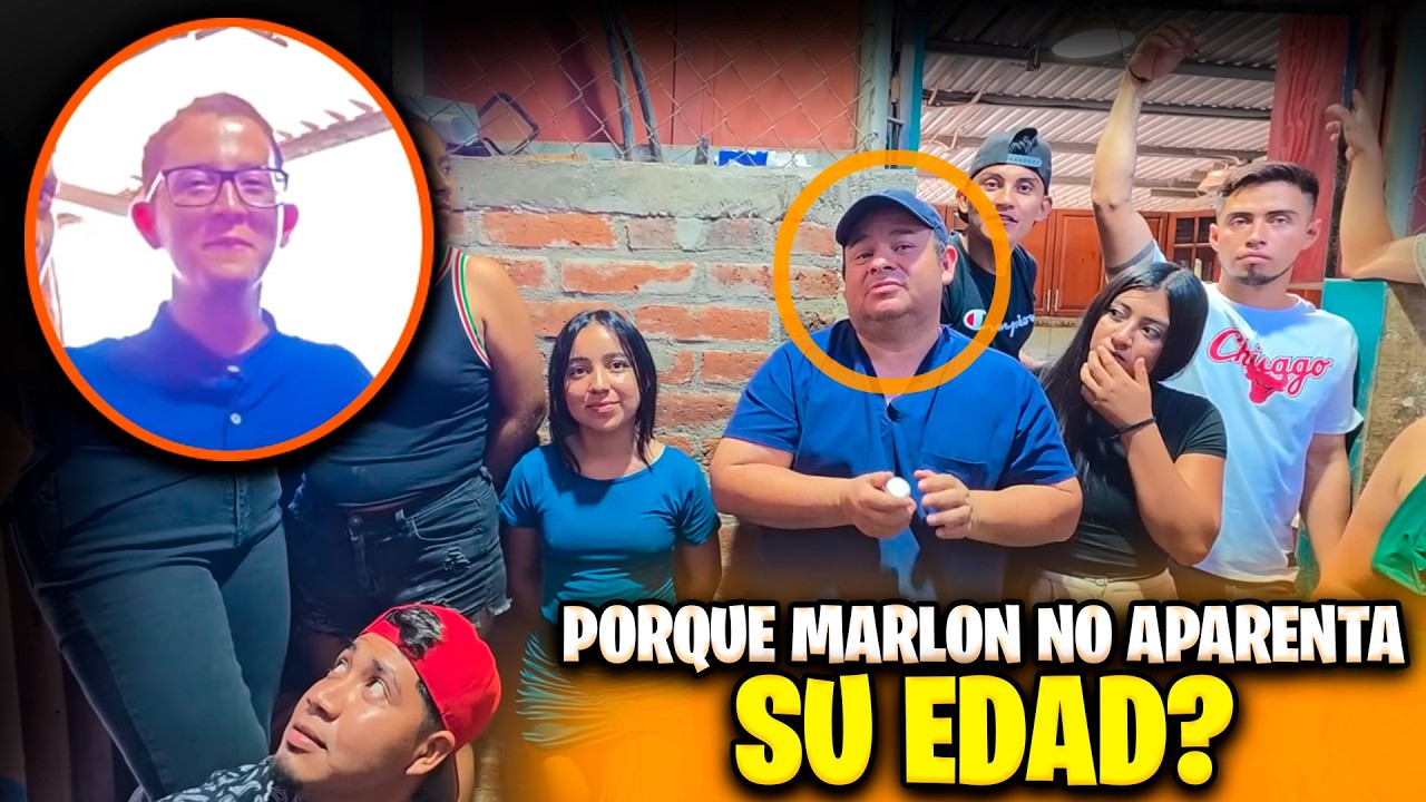 El Doc nos sacó de una gran duda sobre la apariencia de Marlon.