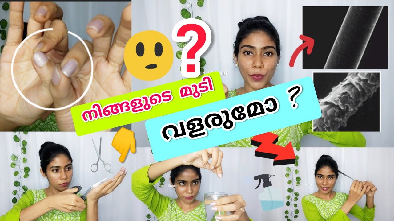 🌸മുടിയിൽ ഇനി ഒന്നും ചെയ്യാൻ ബാക്കി ഇല്ലേ? Know your Hair!!