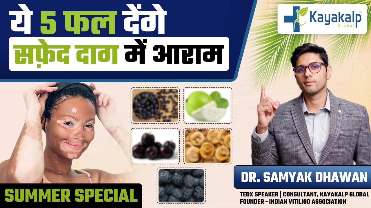 गर्मियों में ये 5 Fruits देंगे Vitiligo में Fast Recovery | Vitiligo Diet in Hindi | Kayakalp Global