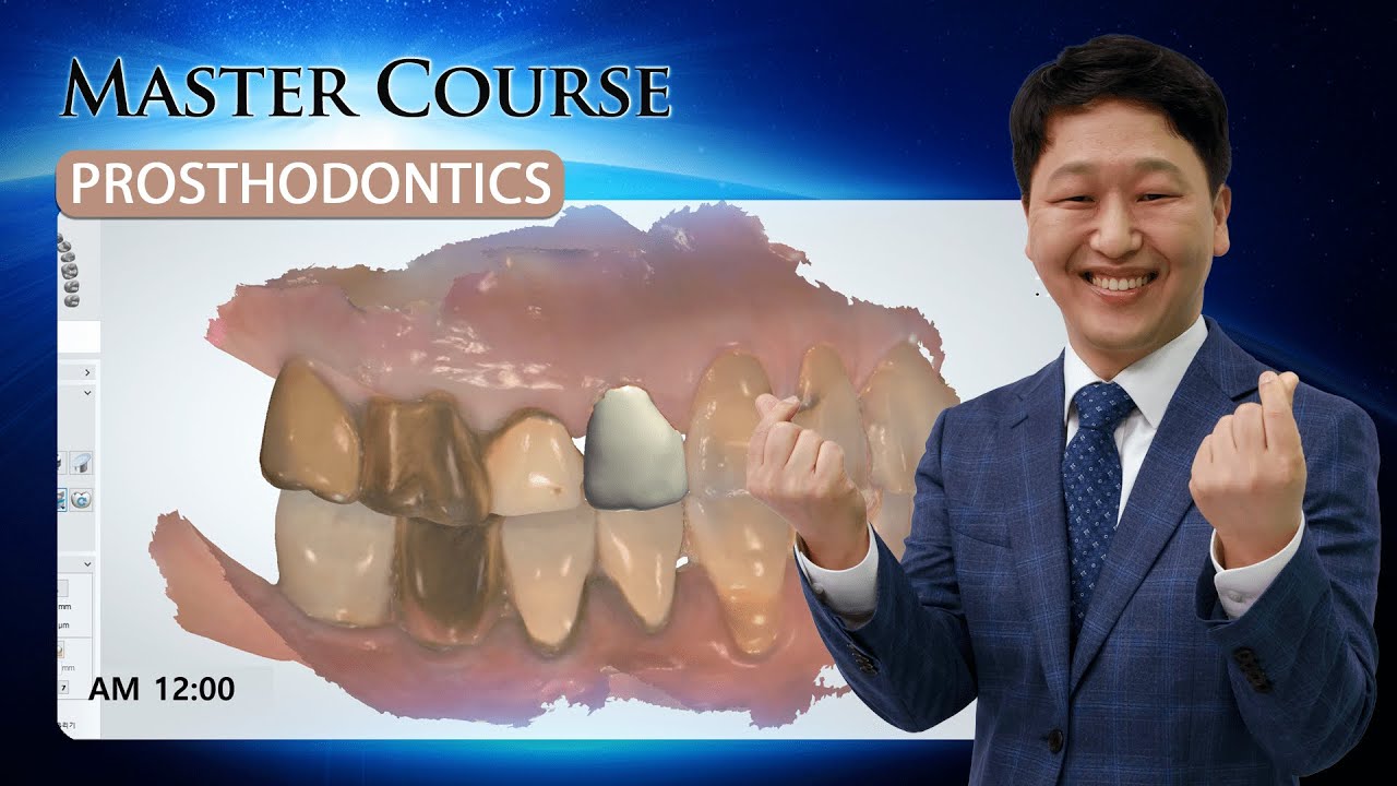 [Master Course - PROSTHODONTICS] One-day prosthesis by digital dentistry
