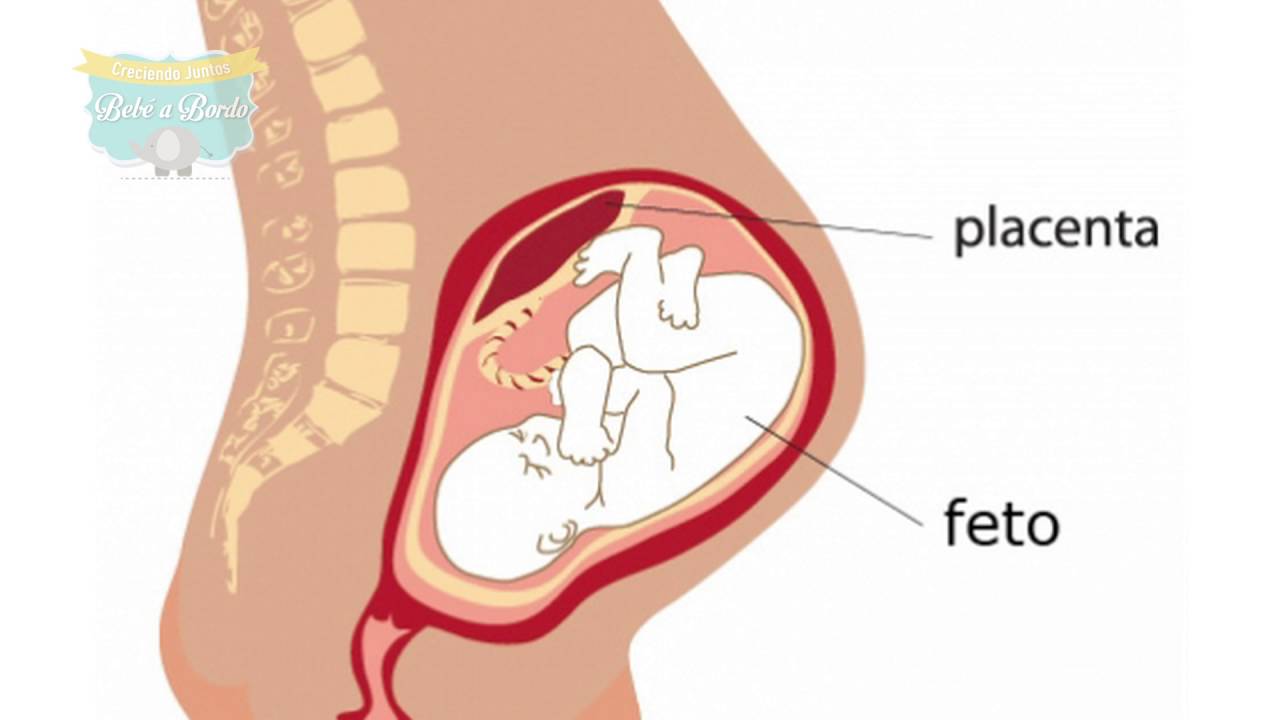Desprendimiento de placenta