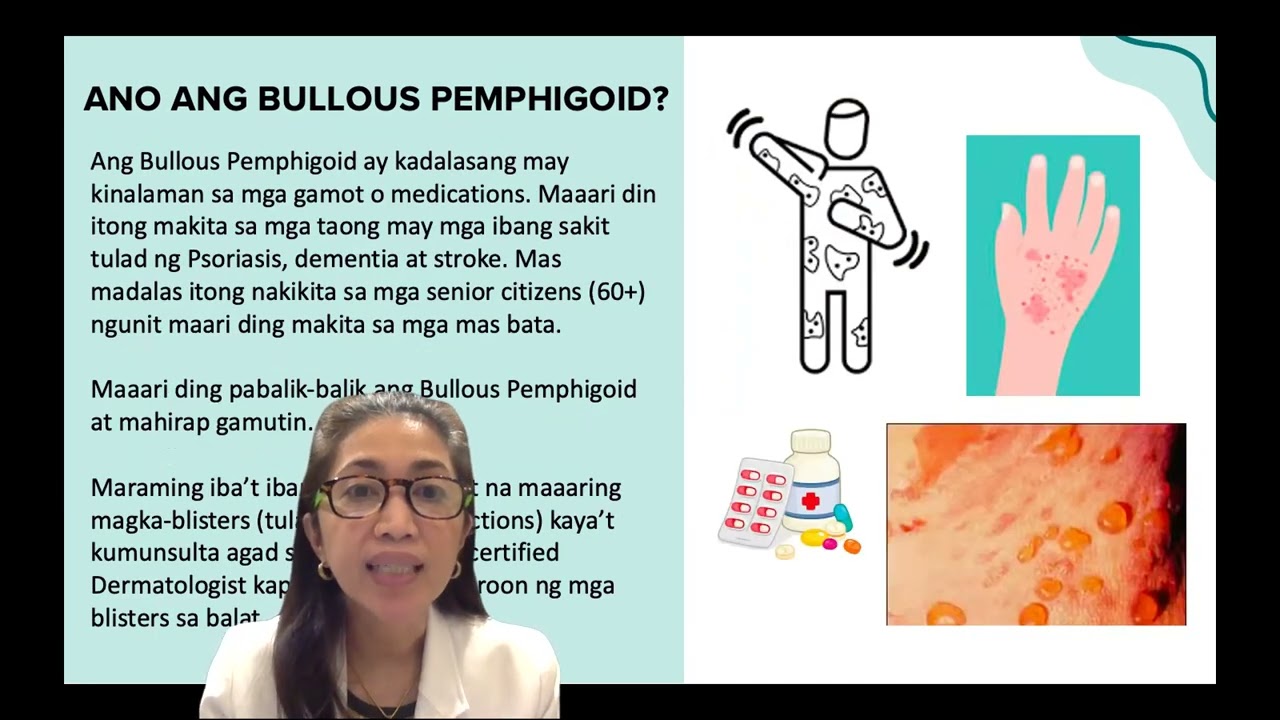 Balat Basics ni Doktora Derma: May Bullous Pemphigoid si Lolo Buboy (by Dr Cecile Clemente-Ocampo)