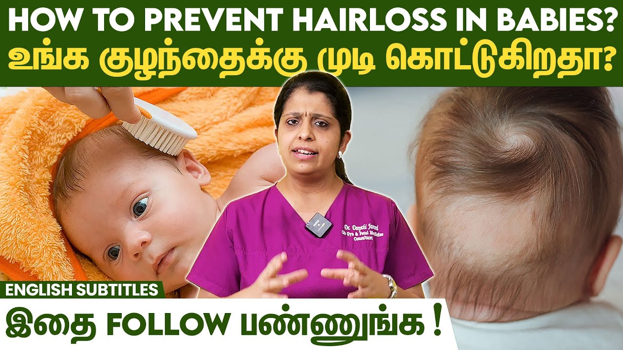 Hairloss In Babies - How To Prevent It | குழந்தையின் முடி உதிர்வை கட்டுப்படுத்த இதை செய்யுங்க!