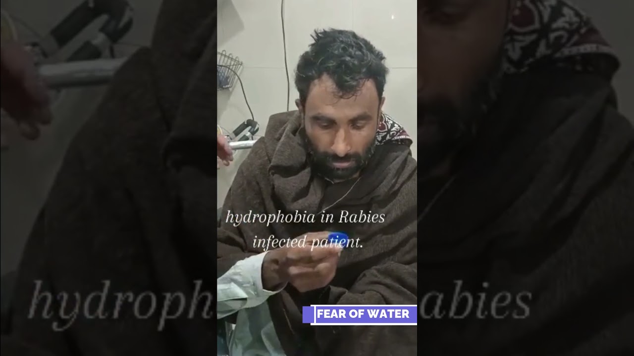 Rabies patient real video #rabies #rabiespatient #fearofgodessentials