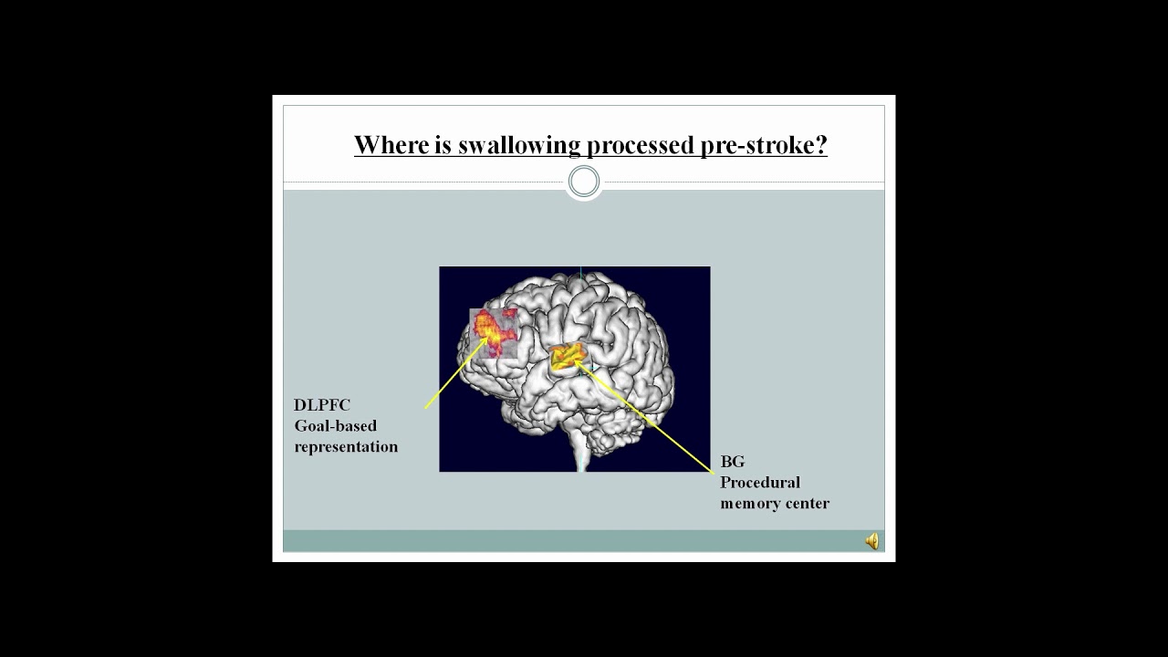 #e209 Preview: Redeveloping Memories to Address Swallowing, Comm. & Rapid Decision Making