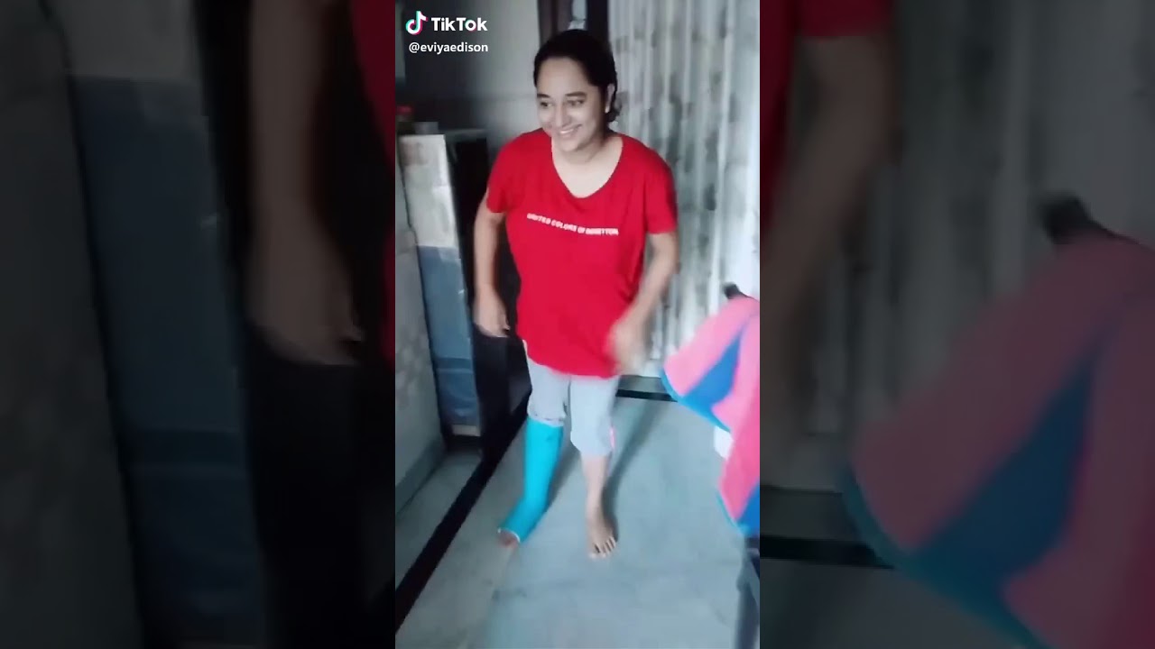 Walking with a plastered foot