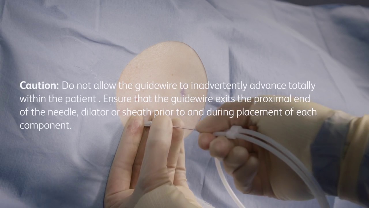 PleurX&reg; pleural catheter placement video