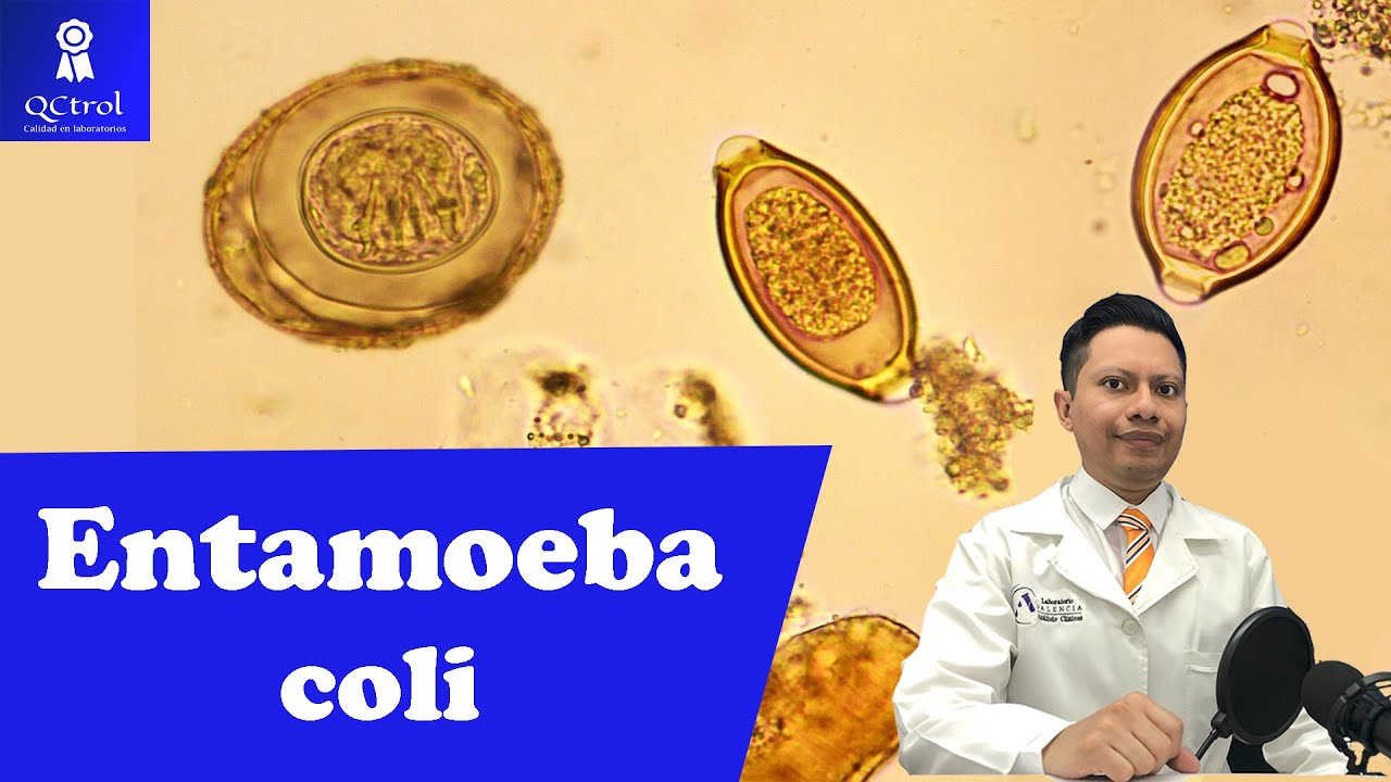 Знакомьтесь, Entamoeba coli: морфология и КЛЮЧИ для ее идентификации, Лаборатория паразитологии 🔬