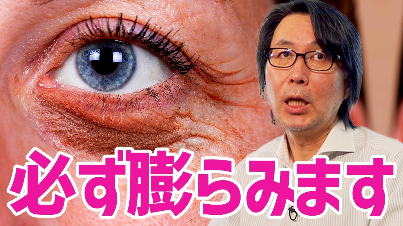 手術で目の下の脂肪をとった後、また膨らんでくることはありますか？