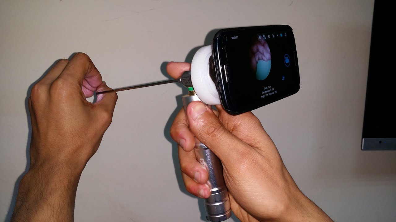 Portable ENT Stuff
