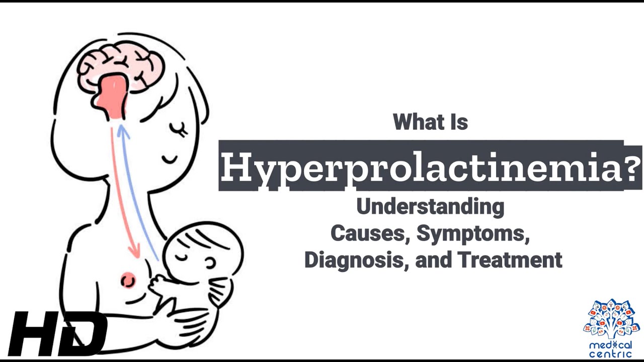 Hyperprolactinemia Unraveled: The Root Causes Revealed