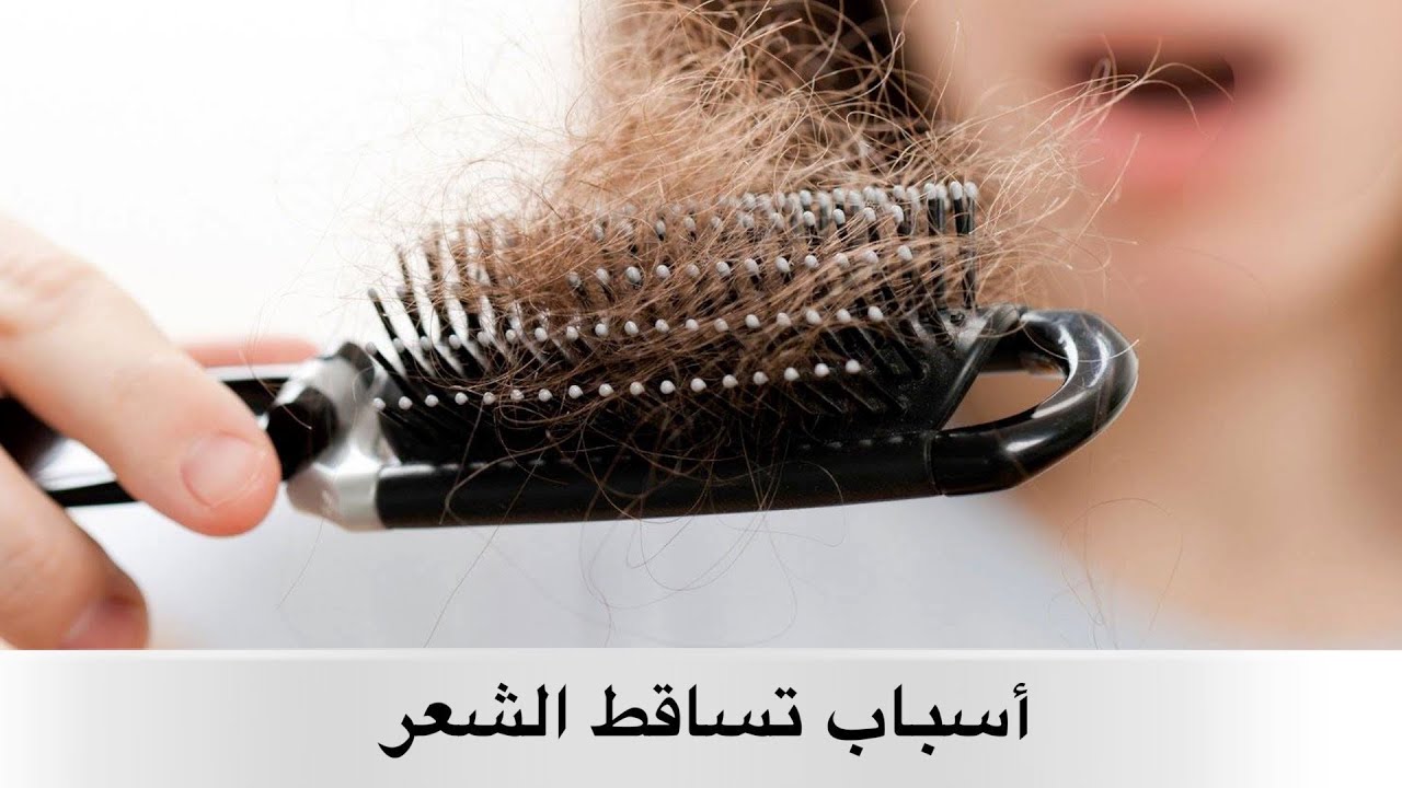 مشاكل الشعر، وطرق علاجها