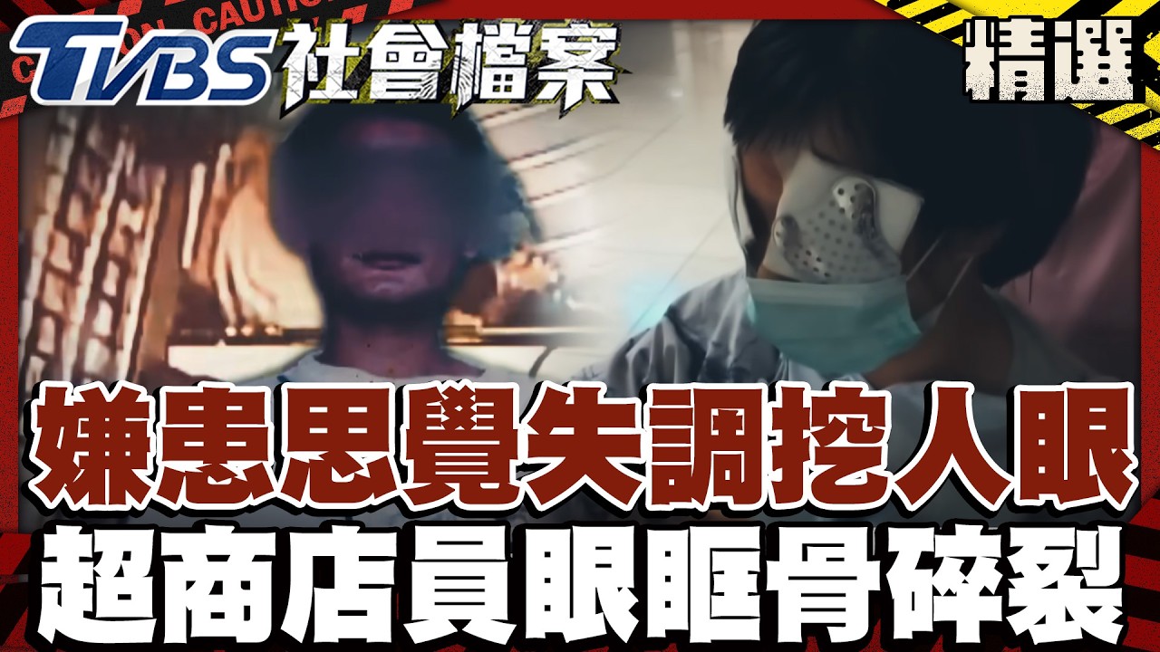 嫌患思覺失調挖人眼！ 超商店員「眼眶骨碎裂」｜#TVBS社會檔案｜#TVBS新聞#思覺失調#超商#碎裂