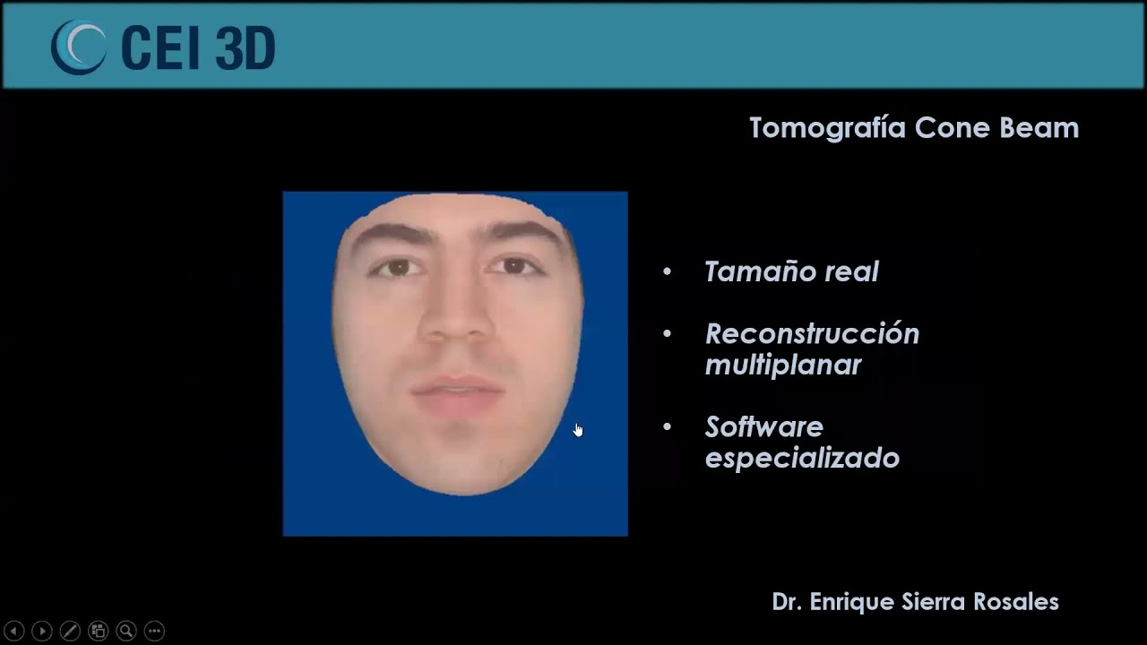 Webinar En que casos solicitar una tomografía cone beam