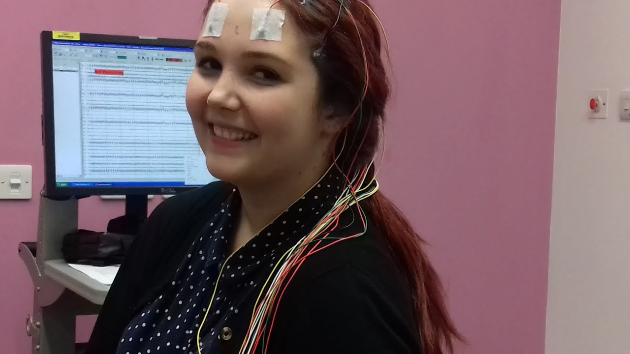 MY 48HR EEG BRAIN SCAN EXPERIENCE