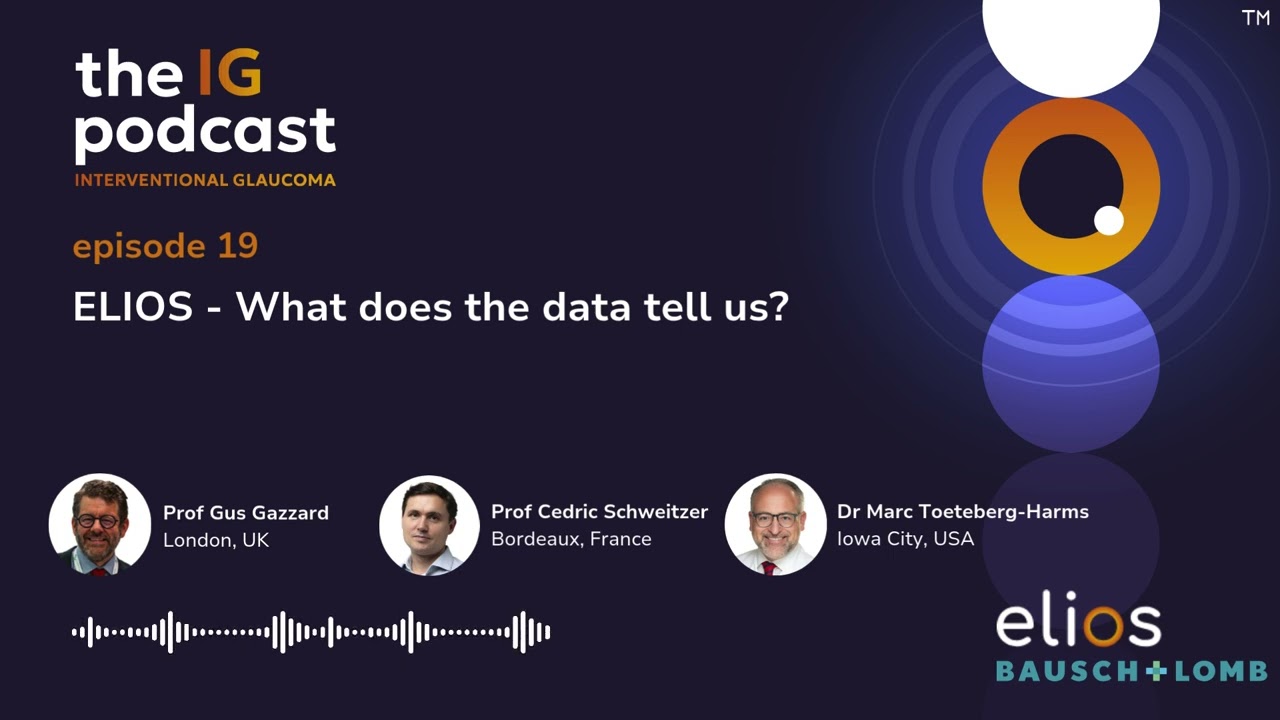 Ep 19. ELIOS - What does the data tell us?