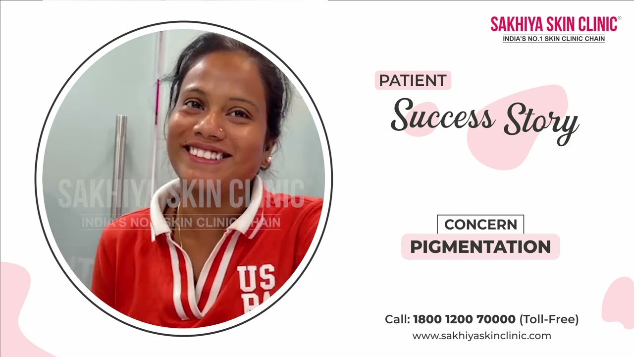 Best Pigmentation Treatment in India | Q-Switch Laser Review at Sakhiya Skin Clinic