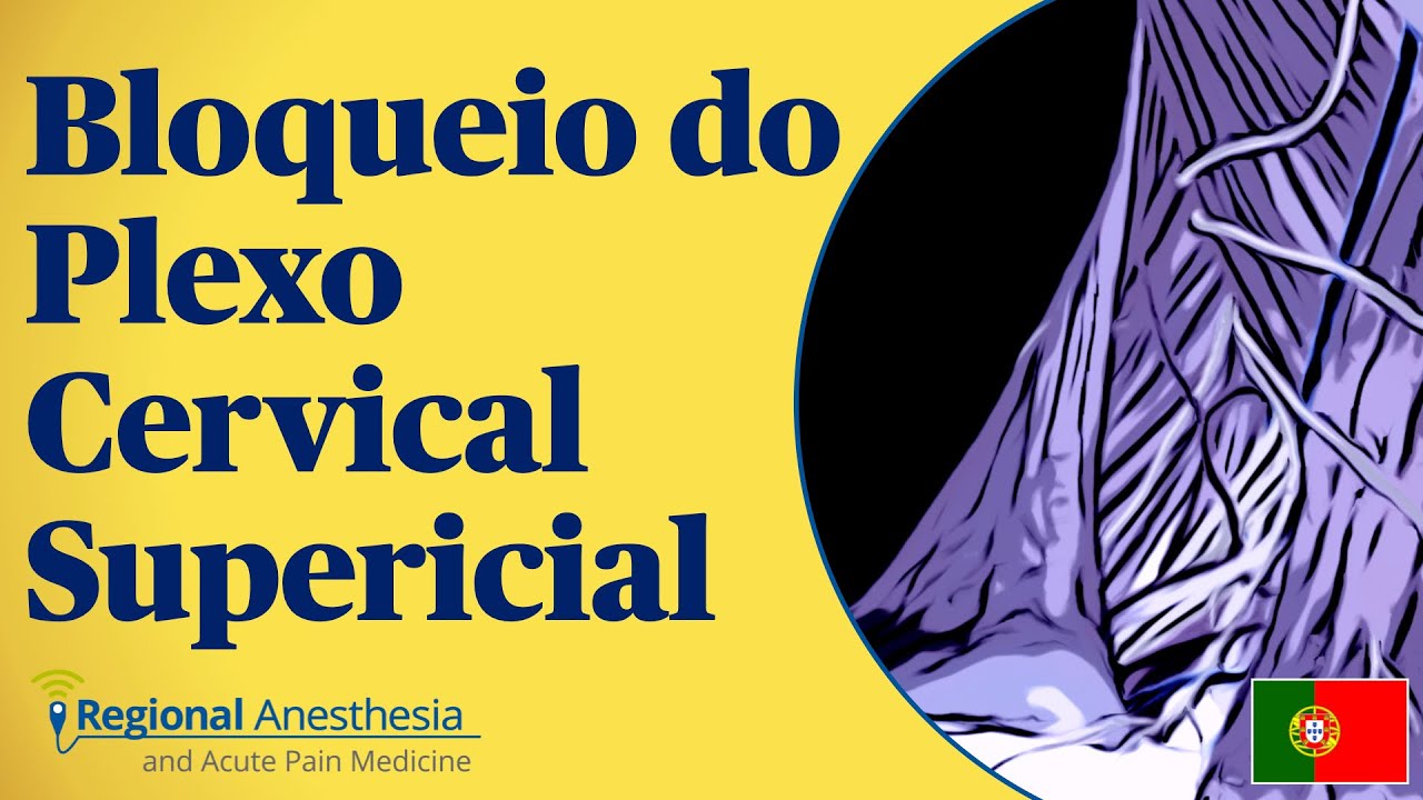 Bloqueio do Plexo Cervical Superficial