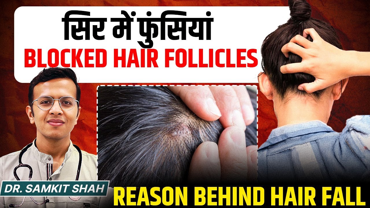 Say GOODBYE to Oily Scalp with This Simple Hair Follicle Cleaning Method