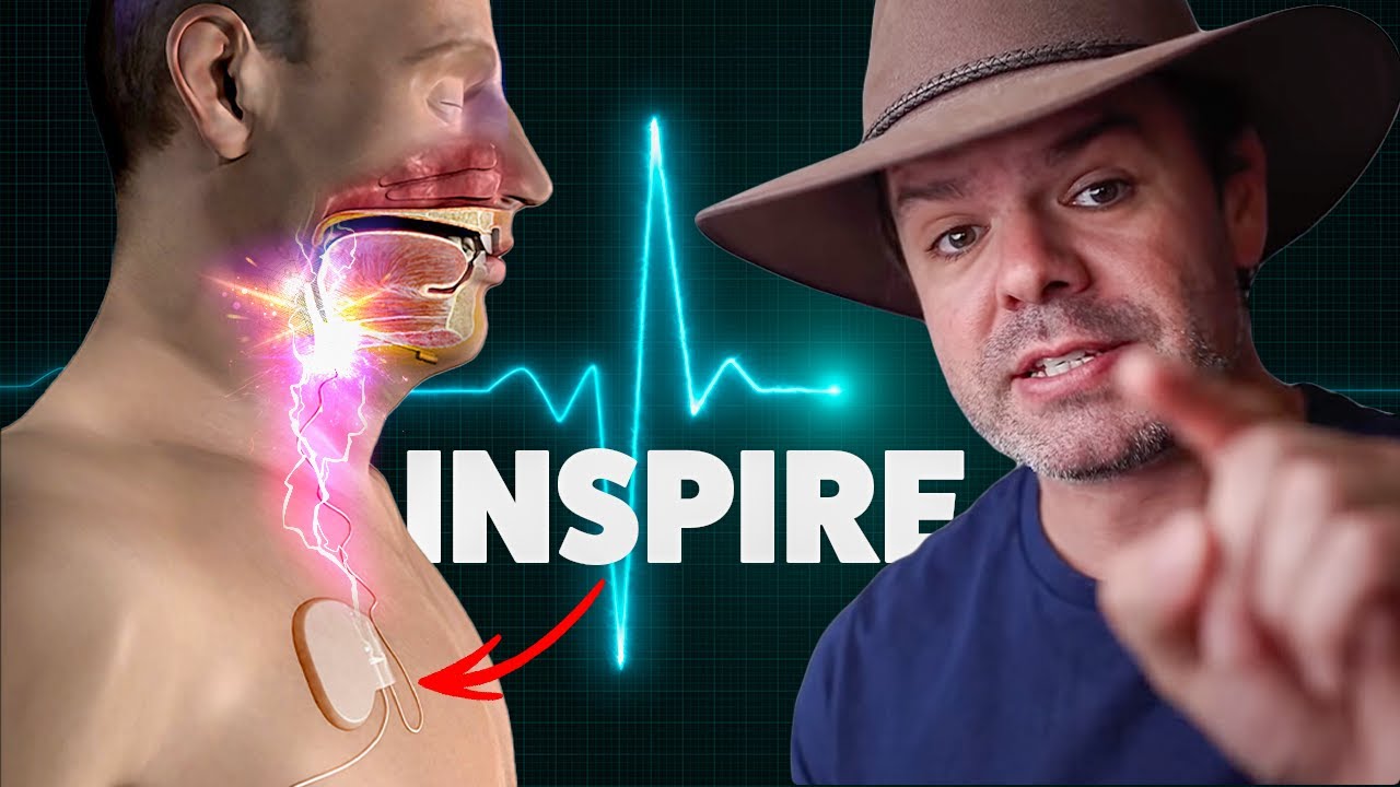 Нервный стимулятор INSPIRE — честный опыт пациентов