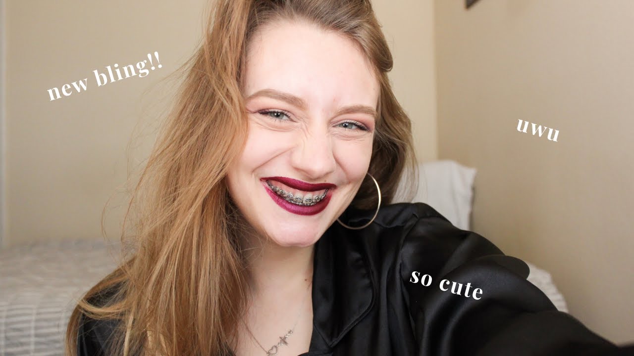 I Got Braces as an Adult // deep overbite + crowding