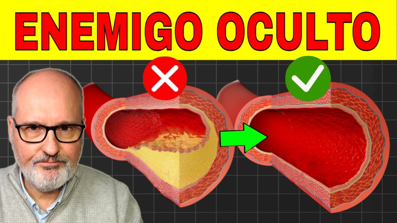 La enfermedad que MATA MÁS que el cáncer y casi nadie detecta