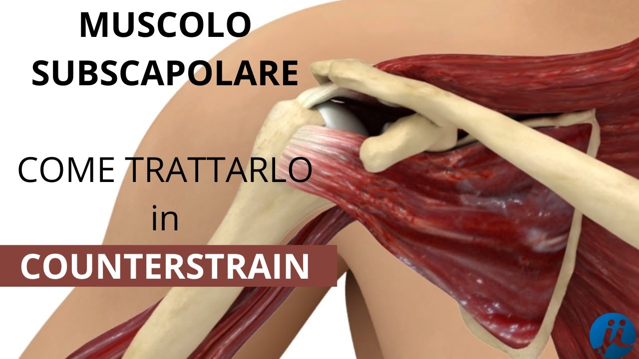 Muscolo SUBSCAPOLARE - Strain Counterstrain - Jones Institute Italia