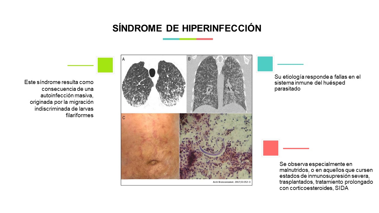 Ateneos Marzo 2021: Strongyloides stercoralis, un parasito subestimado