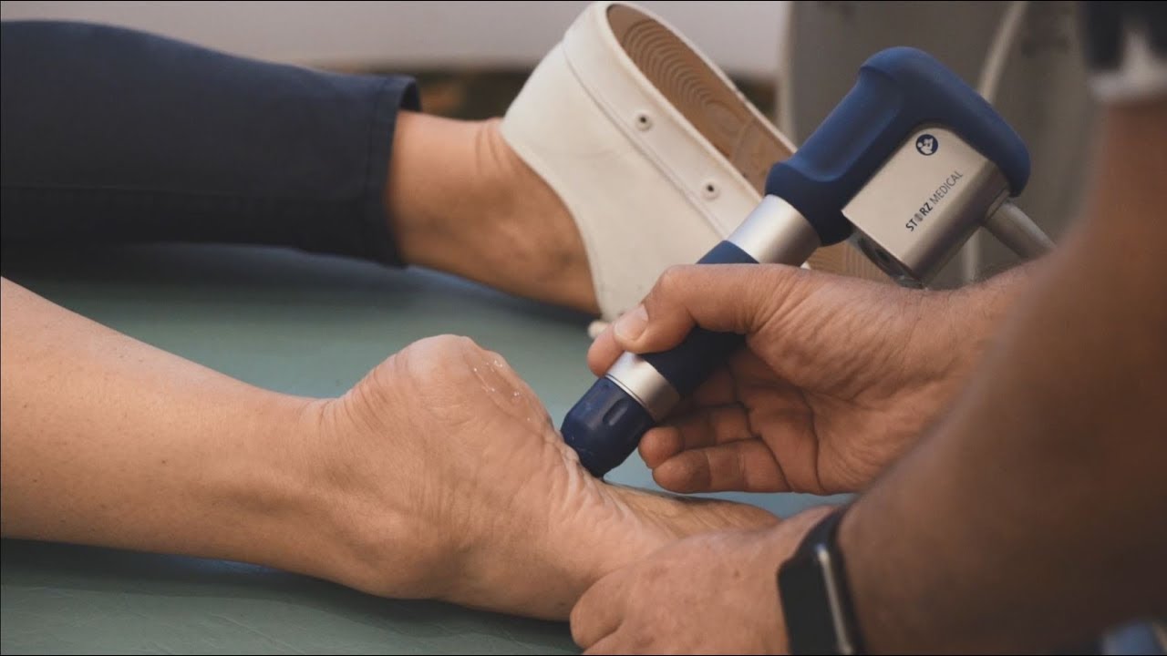 Shockwave Therapy for Plantar Fasciitis - Brisbane Foot Clinic
