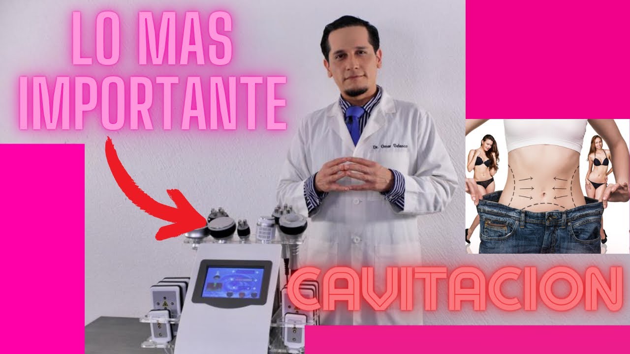 5 PUNTOS CLAVE CAVITACIÓN