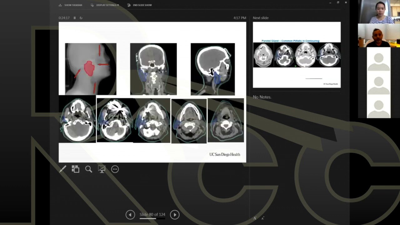 Topic 3 Introduction and overview of H&N Contouring (Part 2)