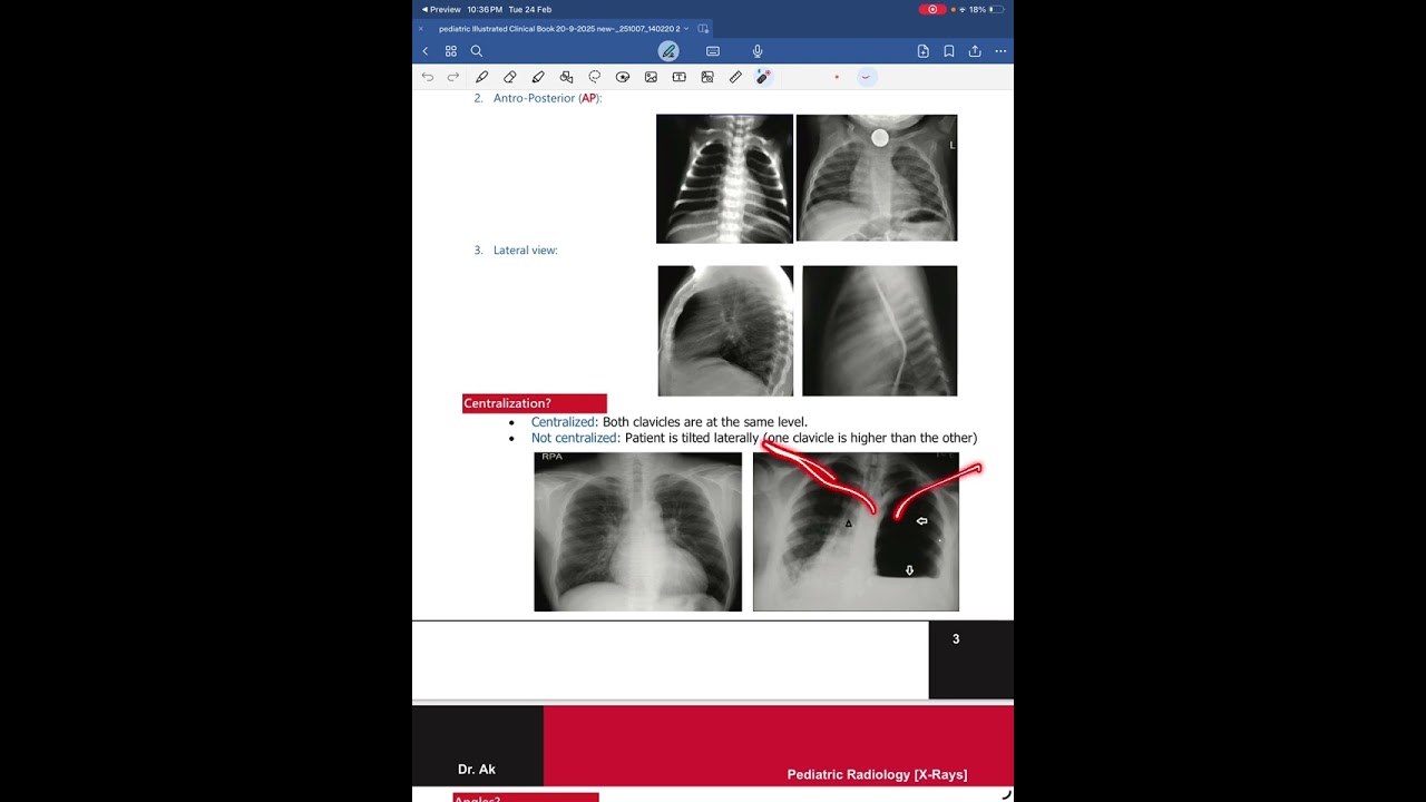 How to read chest x ray 