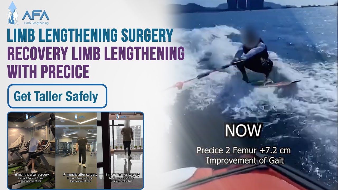 Recovery Limb Lengthening with Precice 2