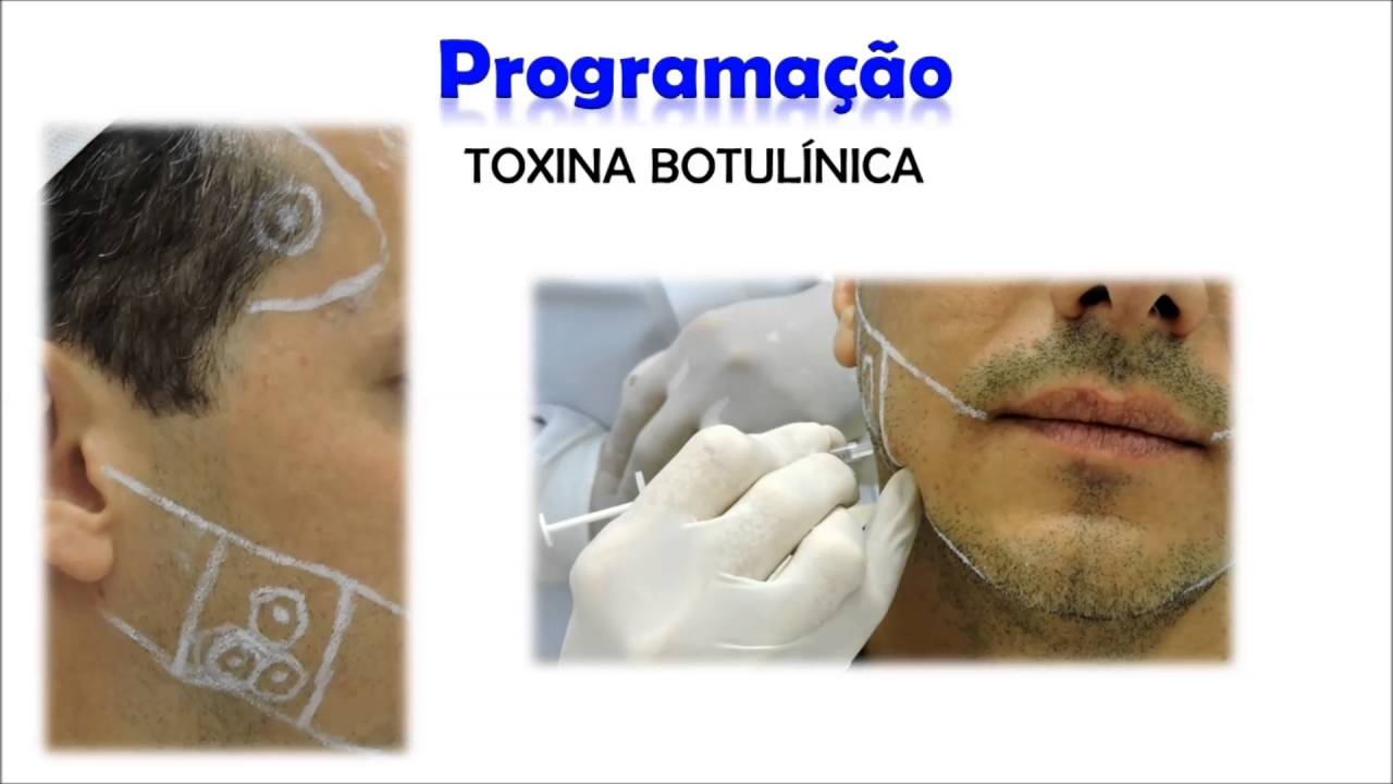 CURSO DE HARMONIZA&Ccedil;&Atilde;O E TERAP&Ecirc;UTICA OROFACIAL