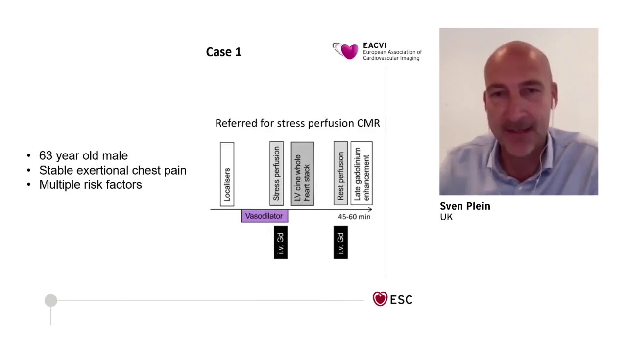 EACVI free webinar: Absolute quantification of myocardial perfusion
