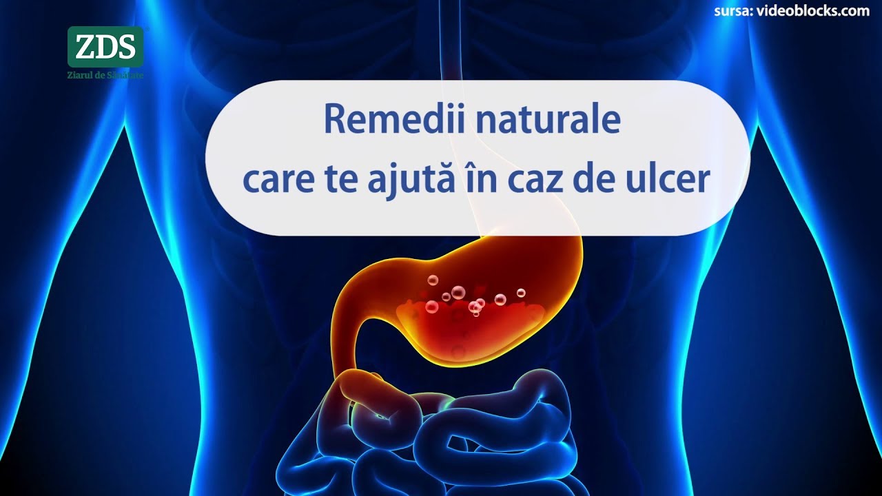 Remedii naturale care te ajută &icirc;n caz de ulcer