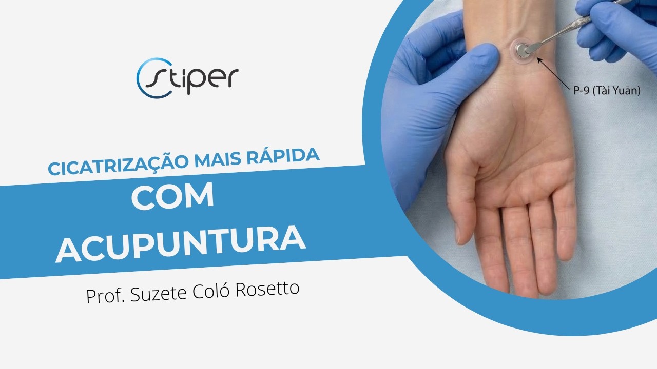 Como acelerar a cicatrização com acupuntura