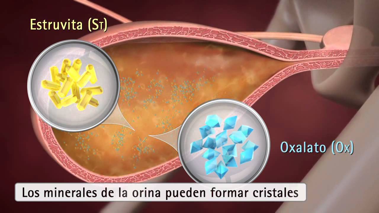 Purina UR St/Ox Urinary para gatos.