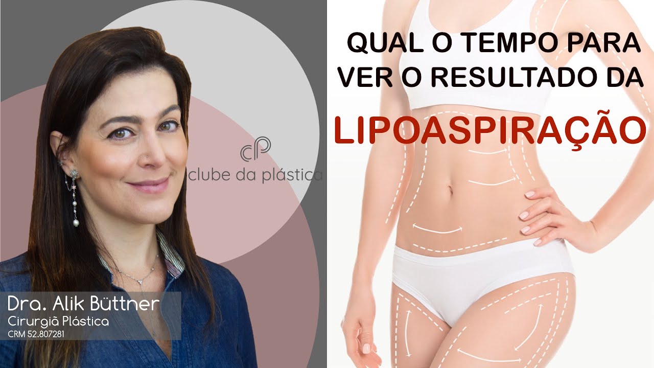 Clube da Plástica: Qual o tempo para ver o resultado da lipoaspiração?