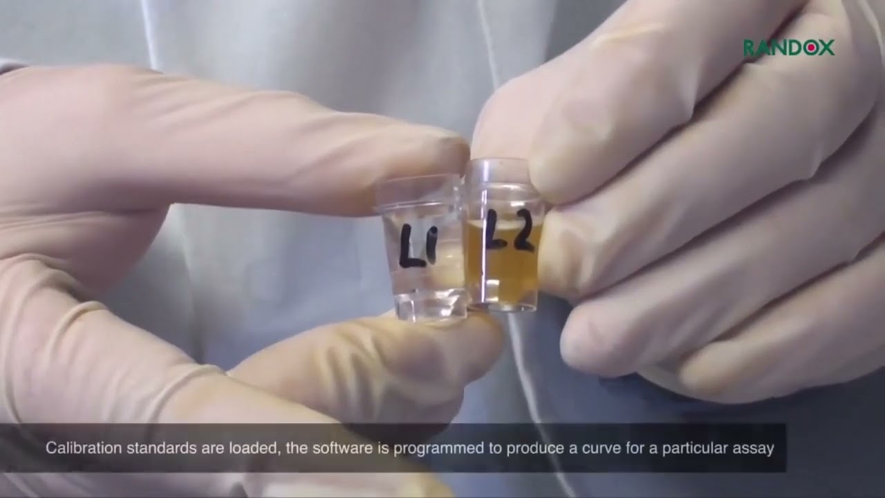 Omnimed Lab Services  automated  liver transaminases