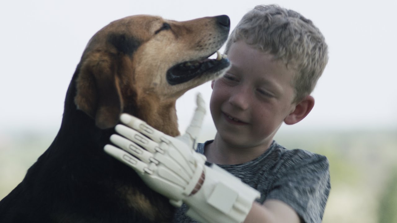 Luke's 3D Printed e-NABLE Hand - Ultimaker: 3D Printing Story