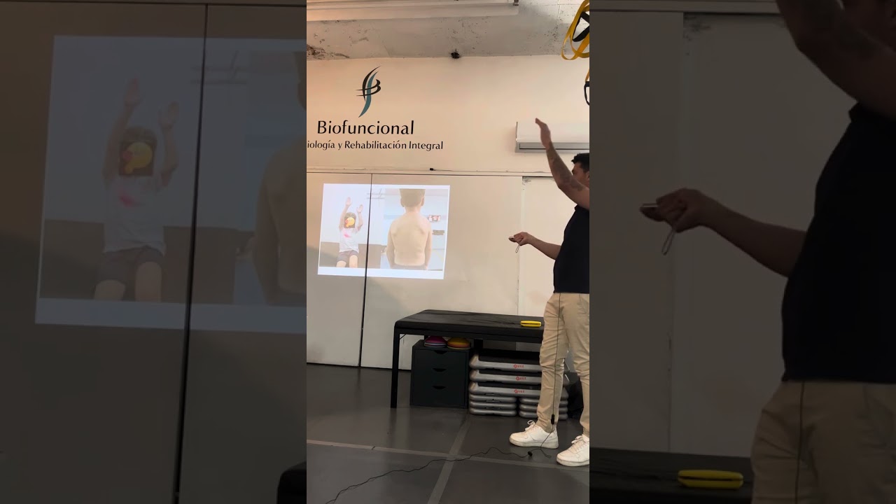 Charla parálisis braquial obstétrica (PBO) parte 2