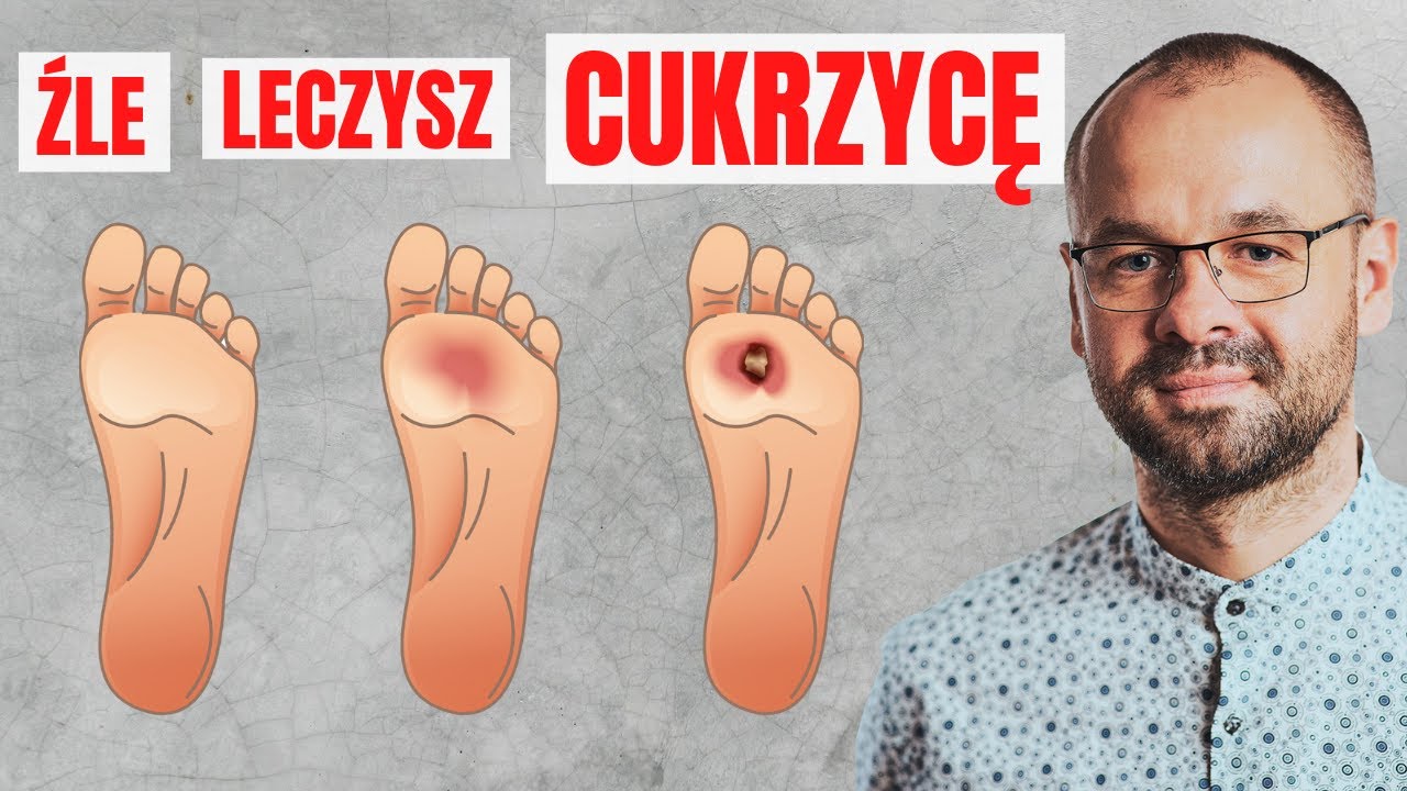 Źle leczysz cukrzycę - sprawdź co musisz zmienić | Marek Skoczylas