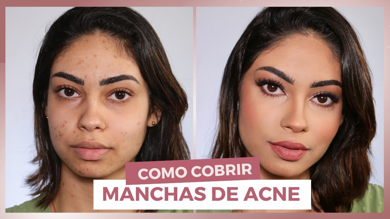 MAQUIAGEM para cobrir manchas de ACNE l Tutorial passo a passo